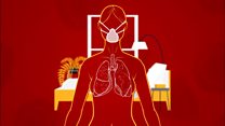 Coronavirus: How long it takes to recover