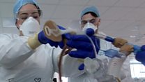 Coronavirus: One week in one hospital
