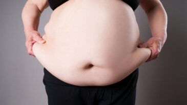 Obese people are more at risk of death in Covid 19